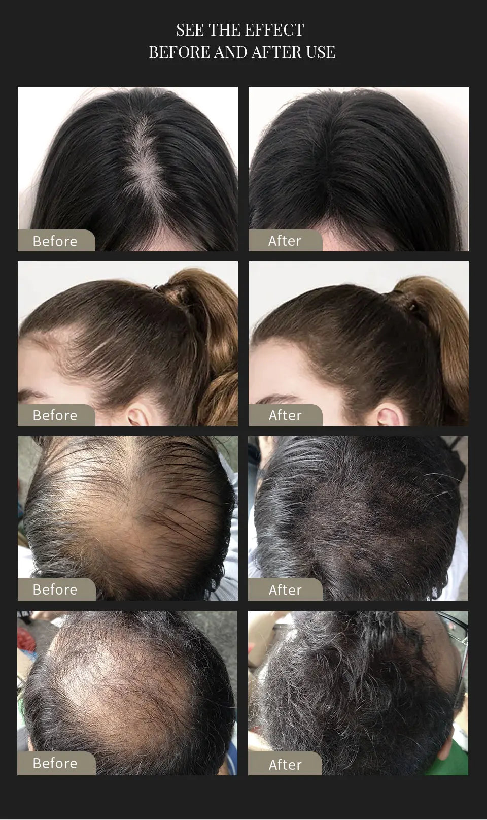 3 pçs conjunto de fibras de cabelo queratina construção do cabelo estilo em pó perda de cabelo instantâneo recrescimento espessamento pós linha fina barba enchimento