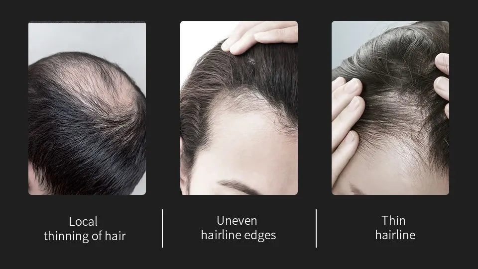 3 pçs conjunto de fibras de cabelo queratina construção do cabelo estilo em pó perda de cabelo instantâneo recrescimento espessamento pós linha fina barba enchimento